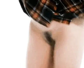 vag