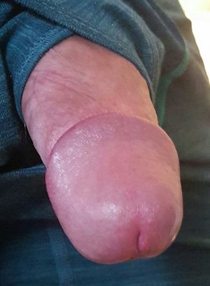 Gallery of my hard cock, soft cock, and some anal play mixed in!