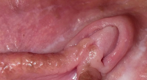 Incredible vagina picture