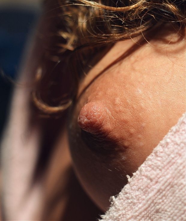 Perfect nip!