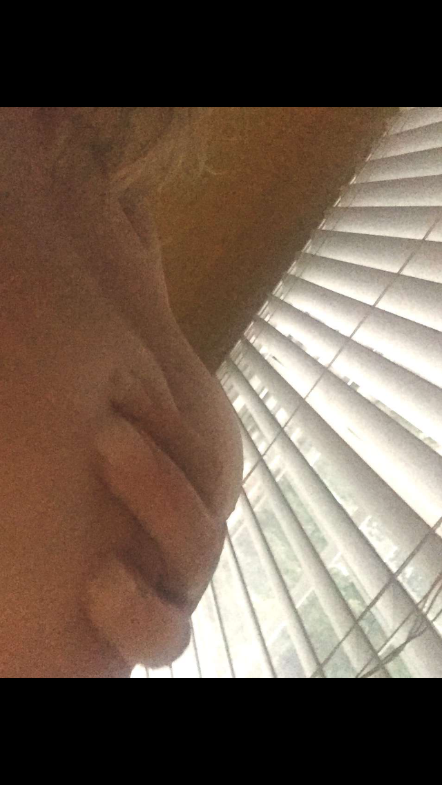 shade