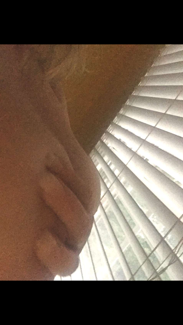 shade