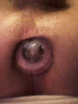 love2gape Picture