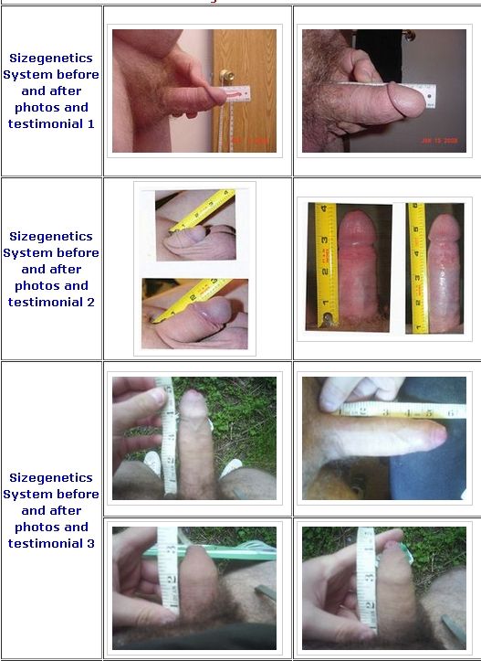SizeGenetics™ Penis Device System - #1 Choice for Penis Enlargement Visit  and save $240!