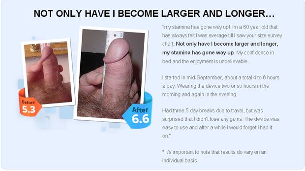 Lot of people are skeptical about Penis Enlargement but here are testimonials