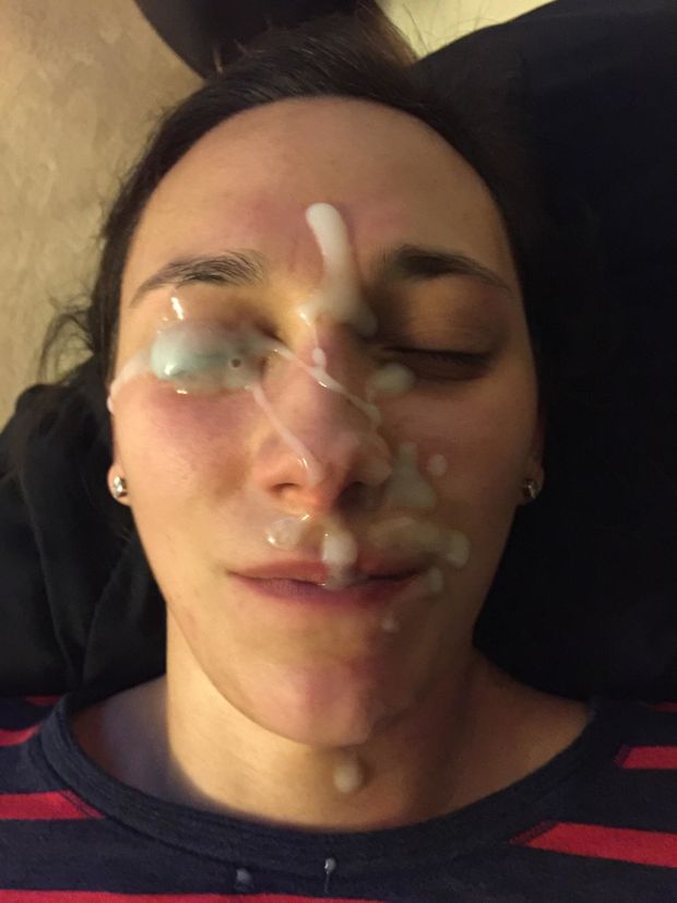 Eye of amateur completely covered