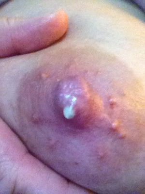 wifeydolly: My leaking breast