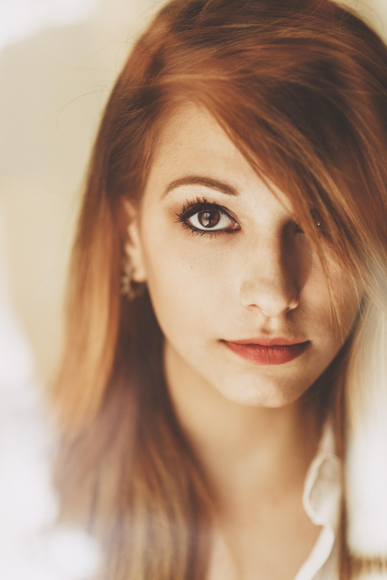 freckles