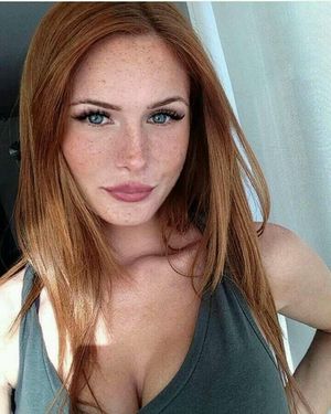 freckles
