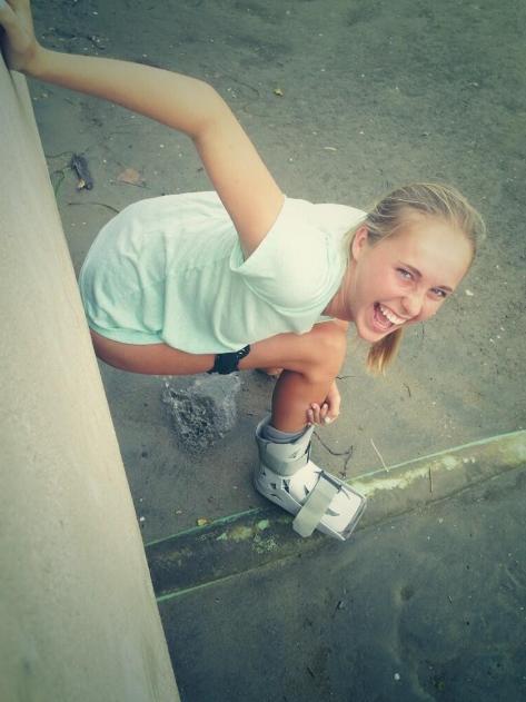 Broken foot