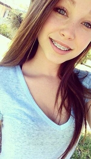 braceface slut