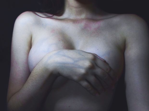 veins