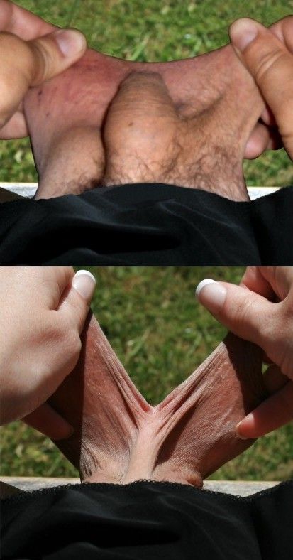 Penis clito