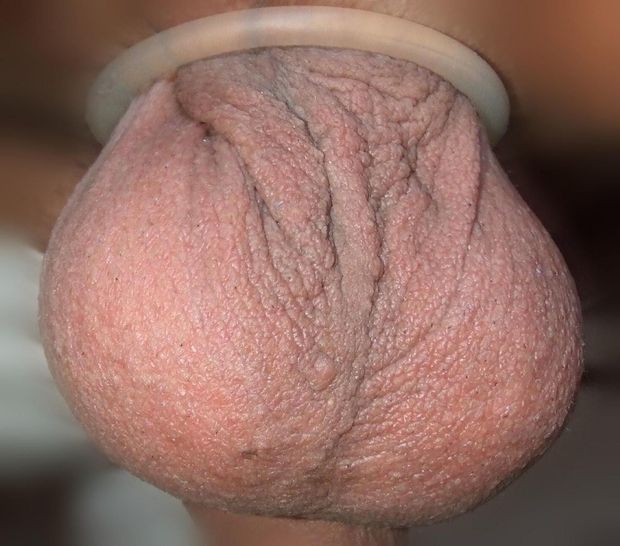 hangers down