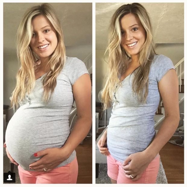 pregnant