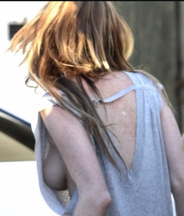 Side boobs