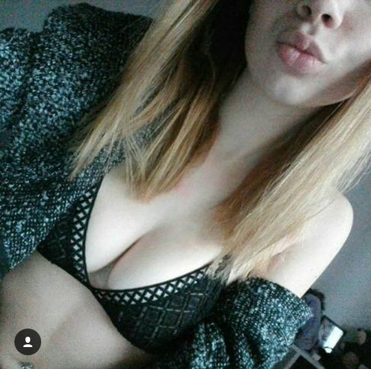 kisses