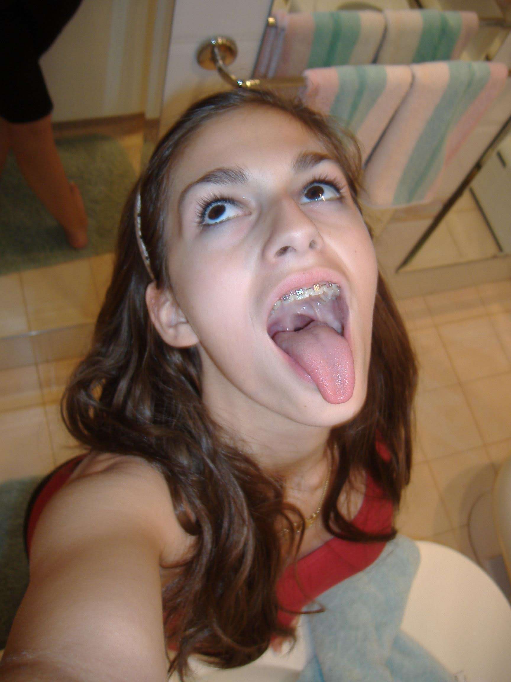 Braces and tongue out