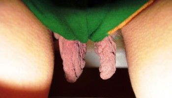longest labia