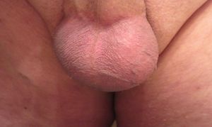 My Balls and Hangers