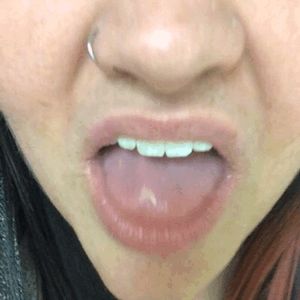 Amateur tongue