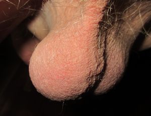 My Balls and Hangers