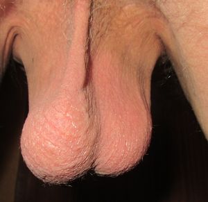 My Balls and Hangers