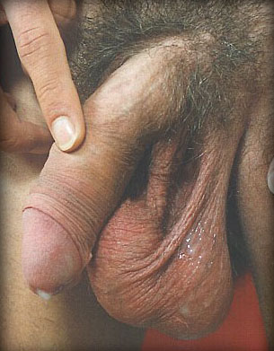 Wet balls