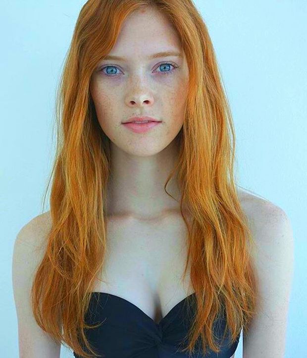 Freckles