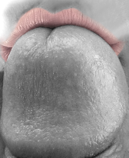 kissing large head