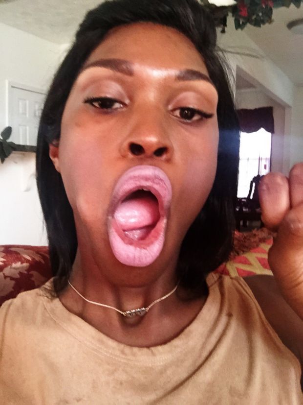 Those Lips