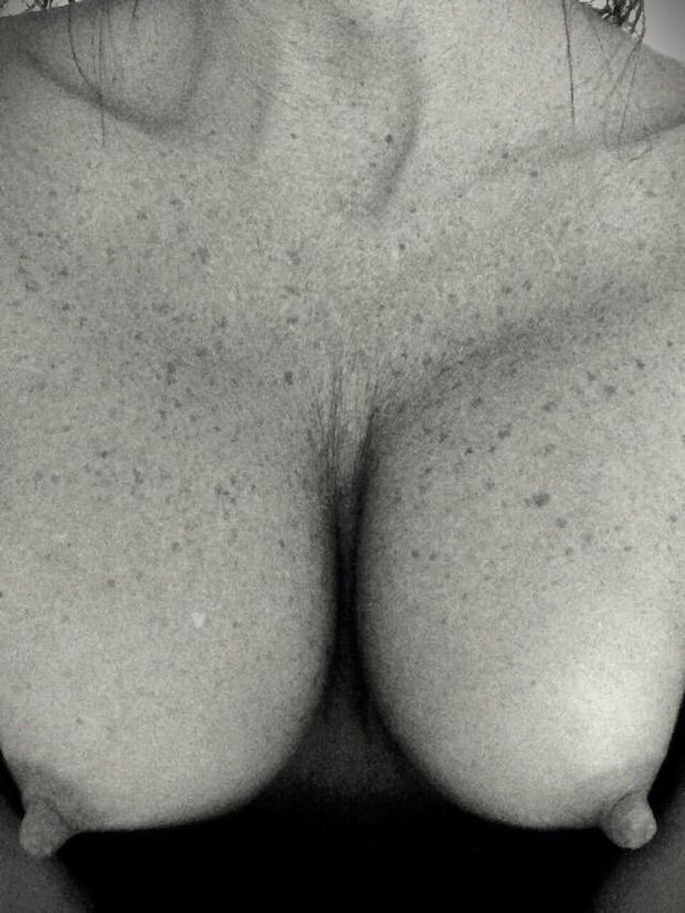Perfect freckles