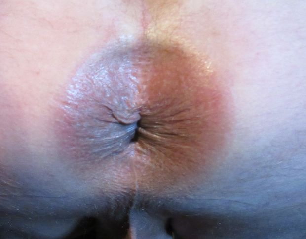Butthole