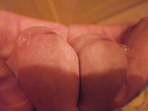 my penis