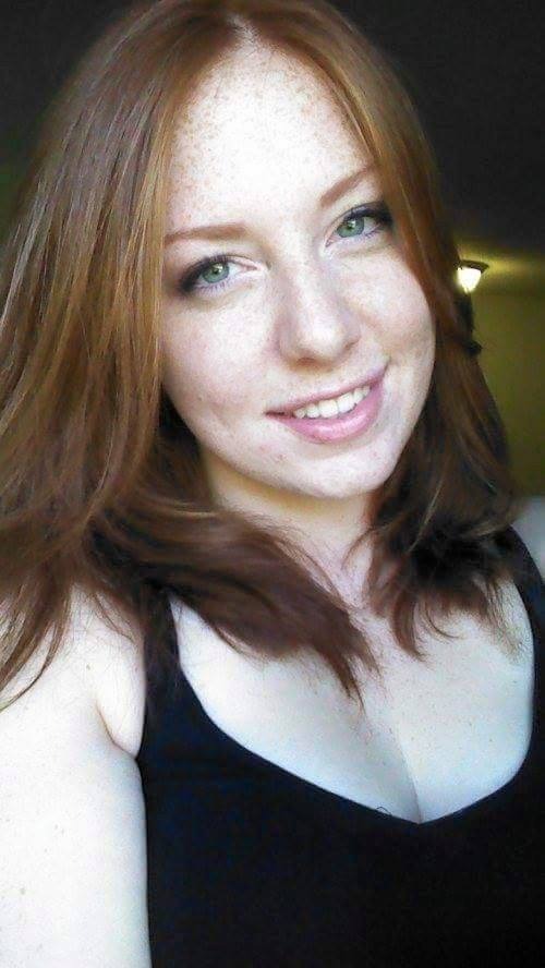 Freckles