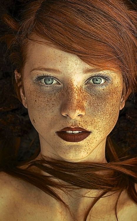 Freckles are so gorgeous. The more the better.