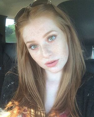 Green eyes & freckles