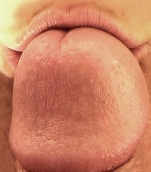 a gentle kiss on the head