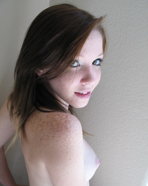 Freckles