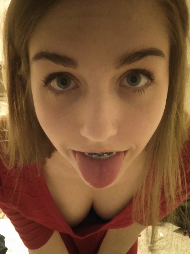 Braces Target