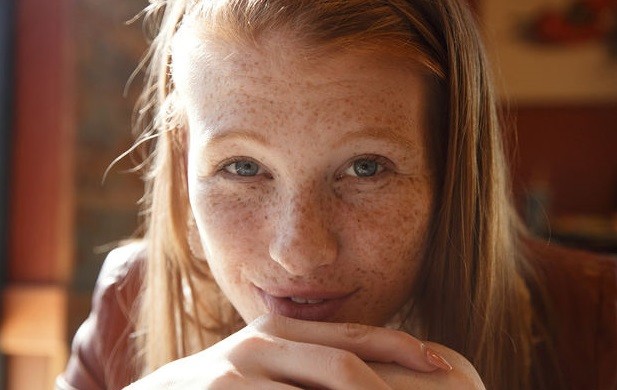 red and freckles