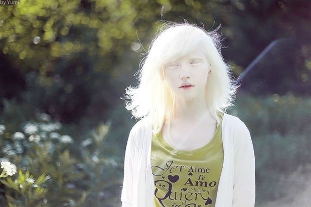 Albino Bunny 5