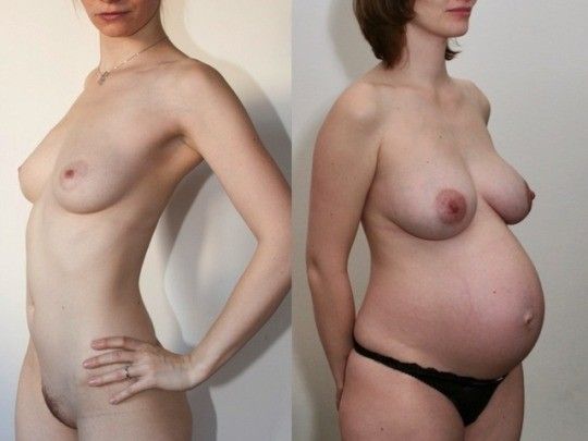 before and after