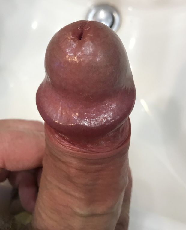 Ready to explode