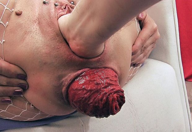 Wcisnął jej pięść w pizdę az wypadła jej odbytnica. Porno fotki Sexpose