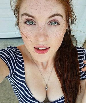 pretty freckles