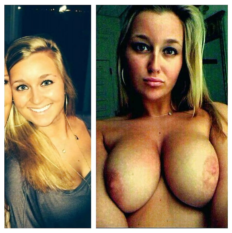 before-after