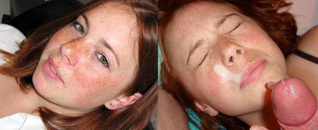 redhead teen before after facial