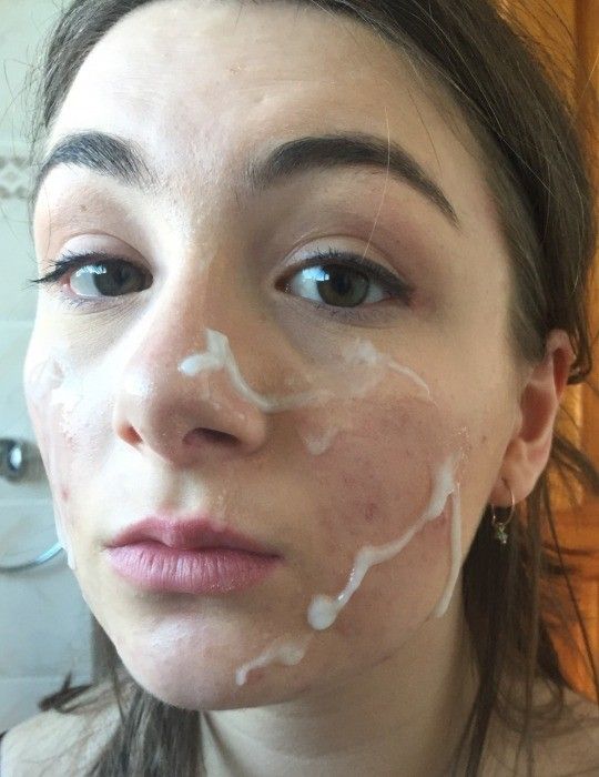 Facials