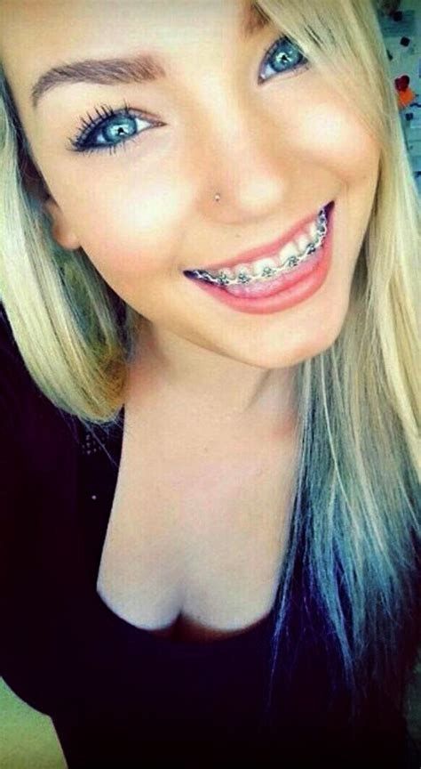 Braces